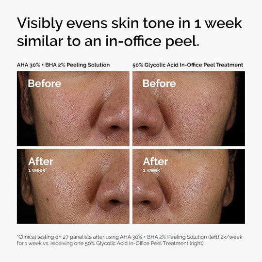 Brighten &amp; Smooth Exfoliating Peel